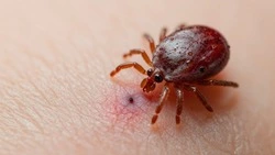 Управление Роспотребнадзора по Белгородской области – о приближающемся сезоне активности клещей